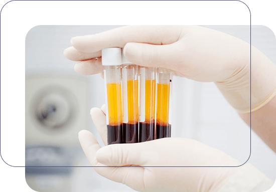 ACP Eigenplasma – Reagenzgläser für PRP in der OSMIUM Praxis